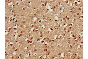 Immunohistochemistry of paraffin-embedded human brain tissue using ABIN7164960 at dilution of 1:100 (PSMA5 antibody  (AA 124-180))