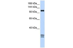 WB Suggested Anti-NCKAP1L Antibody Titration:  0. (NCKAP1L antibody  (C-Term))
