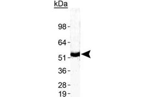 Western blot analysis of ZMPSTE24 in human testis with ZMPSTE24 polyclonal antibody . (ZMPSTE24 antibody  (AA 400-475))