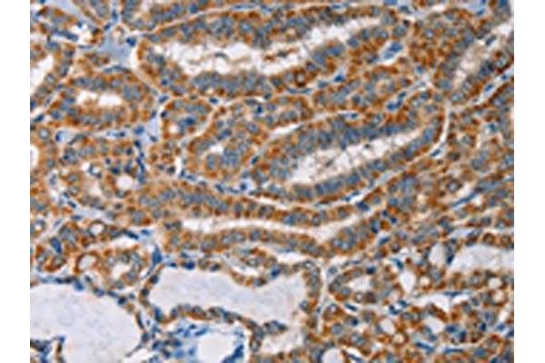 AGPAT4 antibody