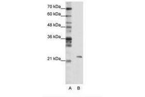 Image no. 1 for anti-Mitochondrial rRNA Methyltransferase 1 Homolog (MRM1) (AA 25-74) antibody (ABIN203015) (MRM1 antibody  (AA 25-74))
