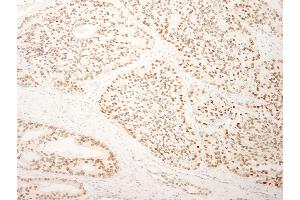 Immunohistochemistry (IHC) image for anti-Splicing Factor, Arginine/serine-Rich 14 (SFRS14) (AA 725-775) antibody (ABIN7449025)