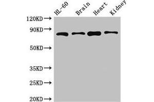 Western Blot Positive WB detected in: HL60 whole cell lysate, Mouse brain tissue, Mouse heart tissue, Mouse kidney tissue All lanes: ABCB9 antibody at 5 μg/mL Secondary Goat polyclonal to rabbit IgG at 1/50000 dilution Predicted band size: 85, 80, 67, 76, 78 kDa Observed band size: 85 kDa