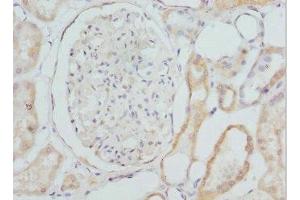 Immunohistochemistry of paraffin-embedded human kidney tissue using ABIN7149278 at dilution of 1:100 (CYP4V2 antibody  (AA 246-525))