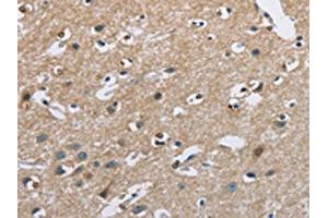 The image on the left is immunohistochemistry of paraffin-embedded Human brain tissue using ABIN7128713(CAB39L Antibody) at dilution 1/40, on the right is treated with fusion protein.