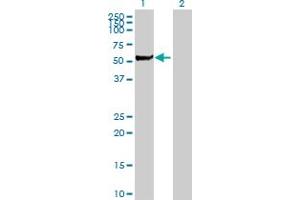 Western Blot analysis of STK3 expression in transfected 293T cell line by STK3 MaxPab polyclonal antibody. (STK3 antibody  (AA 1-491))