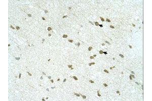 Image no. 1 for anti-Ring Finger Protein 168 (RNF168) (AA 401-450) antibody (ABIN6739167) (RNF168 antibody  (AA 401-450))