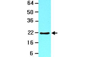 The lysate of Jurkat (20 ug) was resolved by SDS-PAGE and probed with BID monoclonal antibody, clone 4D3  (1:1000).