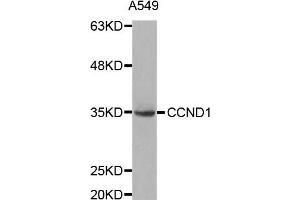 Western blot analysis of extracts of A549 cell lines, using CCND1 antibody. (Cyclin D1 antibody)
