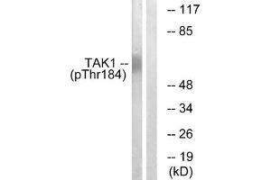 Western blot analysis of extracts from HepG2 cells, treated with TNF (20 ng/mL, 5 mins), using TAK1 (Phospho-Thr184) antibody.