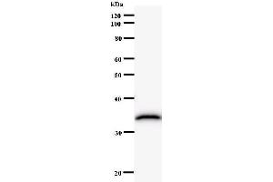 Western Blotting (WB) image for anti-NFS1, Cysteine Desulfurase (NFS1) antibody (ABIN933137)