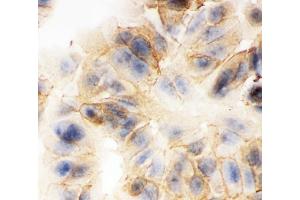 ICC analysis of gamma Catenin using anti-gamma Catenin antibody (ABIN3043864). (JUP antibody  (AA 556-745))