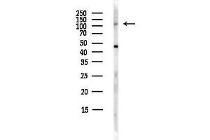 anti-Integrin alpha-8 (ITGA8) (C-Term) antibody
