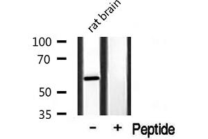 Western blot analysis of extracts from rat Brian, using Cytochrome P450 3A4/5 antibody. (Cytochrome P450 3A4, 3A5 antibody)