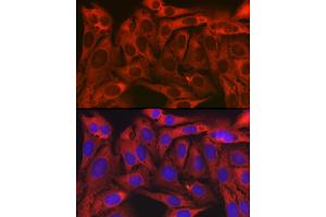 Immunofluorescence analysis of U2OS cells using TXLNA Rabbit pAb (ABIN7270744) at dilution of 1:150 (40x lens). (alpha Taxilin antibody)