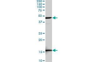 LEF1 monoclonal antibody (M03), clone 5A3. (LEF1 antibody  (AA 14-123))