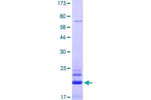 Image no. 1 for Tumor Necrosis Factor Receptor Superfamily, Member 10b (TNFRSF10B) (AA 56-180) protein (His-DYKDDDDK-Strep II Tag) (ABIN3071468)