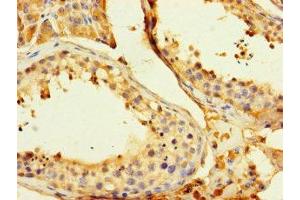 Immunohistochemistry of paraffin-embedded human testis tissue using ABIN7154164 at dilution of 1:100 (GPD2 antibody  (AA 43-727))