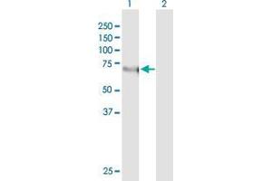 Western Blot analysis of KLF11 expression in transfected 293T cell line by KLF11 monoclonal antibody (M03), clone 10D8. (KLF11 antibody  (AA 404-512))