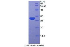 SDS-PAGE (SDS) image for Alanine Aminotransferase (ALT) (AA 203-443) protein (His tag) (ABIN2120491)