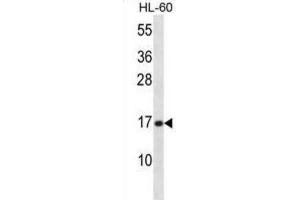 Western Blotting (WB) image for anti-phospholipase A2, Group V (PLA2G5) antibody (ABIN2998220)