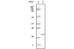 Western blot analysis using EphB4 mouse mAb against truncated EphB4 recombinant protein.