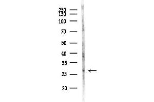 anti-Leucine Rich Repeat Containing 3B (LRRC3B) antibody