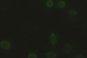 Anti-SOX17 mouse monoclonal antibody (ABIN2452673) immunofluorescent staining of HeLa cells transiently transfected by pCMV6-ENTRY SOX17 (RC220888) (SOX17 antibody  (AA 177-414))