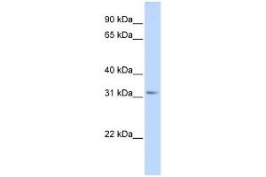 SCGN antibody used at 1 ug/ml to detect target protein. (SCGN antibody  (Middle Region))