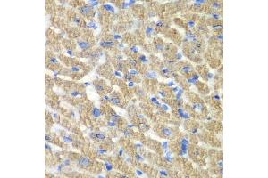 Immunohistochemistry of paraffin-embedded mouse heart using FIBP antibody  at dilution of 1:100 (40x lens). (FIBP antibody  (AA 1-364))