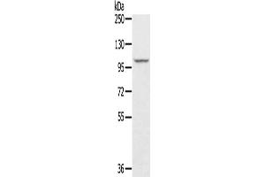 Gel: 6 % SDS-PAGE, Lysate: 40 μg, Lane: A549 cells, Primary antibody: ABIN7131212(STARD8 Antibody) at dilution 1/250, Secondary antibody: Goat anti rabbit IgG at 1/8000 dilution, Exposure time: 10 seconds (STARD8 antibody)