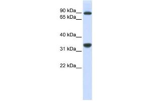 Western Blotting (WB) image for anti-Ribosomal RNA Processing 1 Homolog B (RRP1B) antibody (ABIN2458964) (RRP1B antibody)