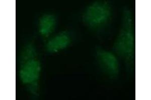 Immunofluorescence (IF) image for anti-ADAM Metallopeptidase with thrombospondin Type 1 Motif, 8 (ADAMTS8) antibody (ABIN1496471) (ADAMTS8 antibody)