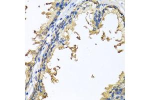 Immunohistochemistry of paraffin-embedded human prostate using NLGN4Y antibody (ABIN6133011, ABIN6144652, ABIN6144653 and ABIN6220667) at dilution of 1:100 (40x lens). (Neuroligin Y antibody  (AA 122-256))