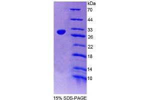 SDS-PAGE analysis of Human SGCd Protein.