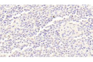 Immunohistochemistry (IHC) image for anti-B Lymphoid Tyrosine Kinase (BLK) (AA 241-494) antibody (ABIN7441157)