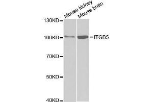 Western blot analysis of extracts of various cell lines, using ITGB5 antibody. (Integrin beta 5 antibody  (AA 490-720))