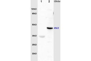 L1 rat brain lysates L2 mouse plasma lysates probed with Anti Fibrinogen gamma chain Polyclonal Antibody, Unconjugated (ABIN872908) at 1:200 in 4 °C. (FGG antibody  (AA 151-250))