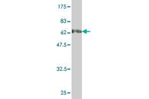 Western Blot detection against Immunogen (72. (SMPD2 antibody  (AA 1-423))