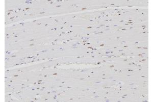 ABIN6276467 at 1/100 staining Rat heart tissue by IHC-P. (IRF4 antibody  (C-Term))