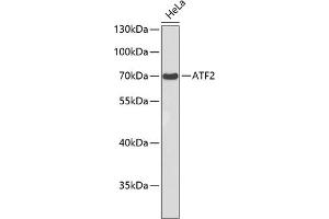 Western blot analysis of extracts of HeLa cells, using  antibody . (ATF2 antibody)