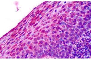 Anti-Adenosine A3 Receptor / ADORA3 antibody IHC staining of human tonsil, squamous epithelium. (Adenosine A3 Receptor antibody  (Cytoplasmic Domain))