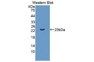 Western Blotting (WB) image for anti-Interleukin 11 (IL11) (AA 25-199) antibody (ABIN3209544) (IL-11 antibody  (AA 25-199))