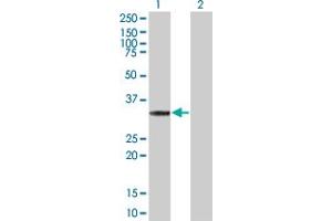 Lane 1: CDK5 transfected lysate ( 33. (CDK5 293T Cell Transient Overexpression Lysate(Denatured))
