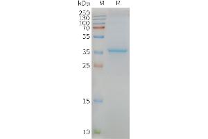 Human -Nanodisc, Flag Tag on SDS-PAGE (MLC1 Protein)