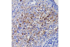 Immunohistochemistry of paraffin-embedded rat ovary using SOD2 antibody (ABIN7270638) at dilution of 1:100 (40x lens). (SOD2 antibody)