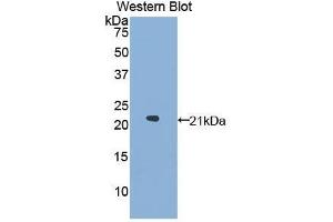 Western Blotting (WB) image for anti-Glucosidase, Alpha, Acid (GAA) (AA 595-770) antibody (ABIN1858936) (GAA antibody  (AA 595-770))