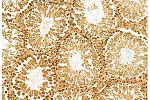 ABIN6263746 and ABIN6272947 at 1/100 staining Rat testis tissue by IHC-P.