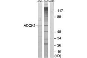 Western blot analysis of extracts from A549/RAW264. (ADCK1 antibody  (AA 251-300))