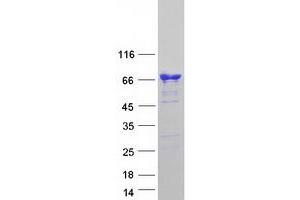 Western Blotting (WB) image for Calcium/calmodulin-Dependent Protein Kinase Kinase 1, alpha (CAMKK1) (Transcript Variant 2) protein (Myc-DYKDDDDK Tag) (ABIN2713098)